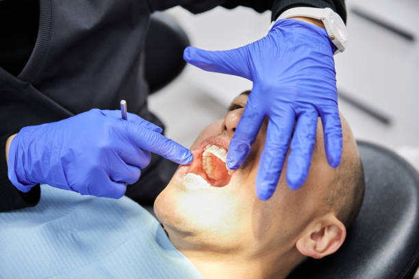Best Emergency Treatment for Dental Infections or Abscesses in Paris, IL